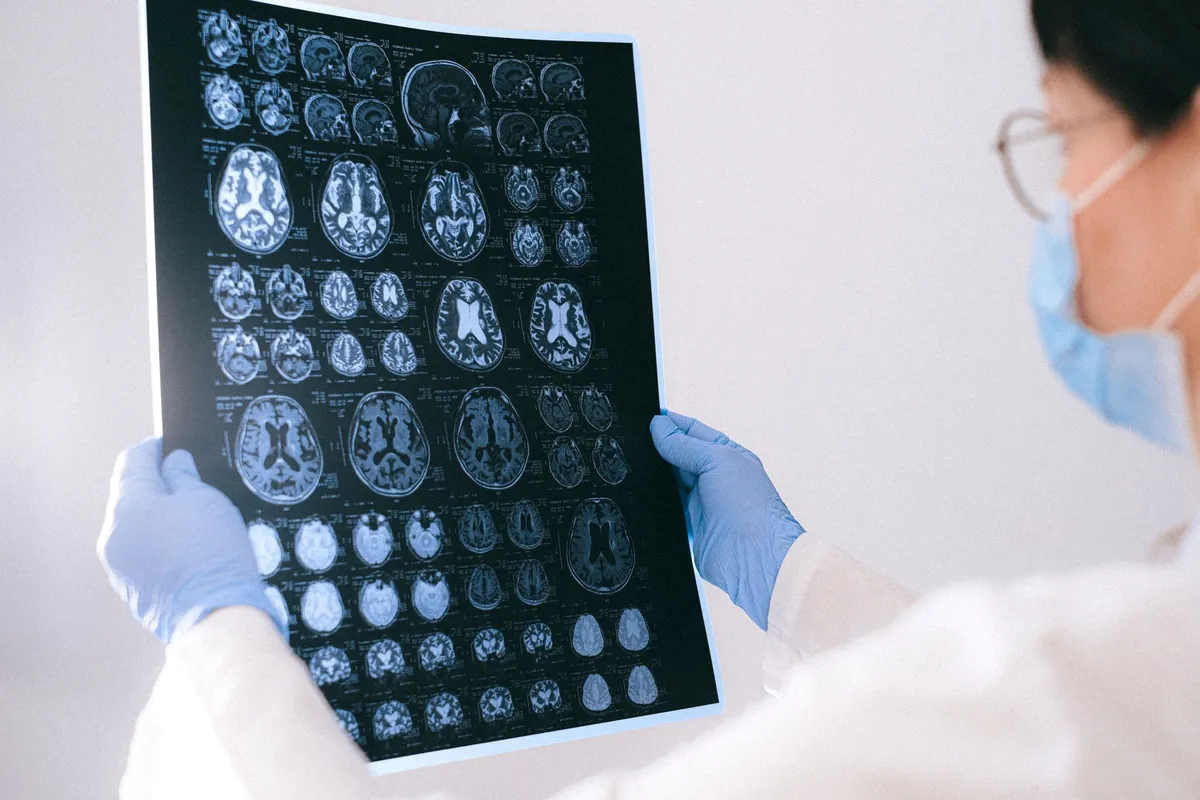 Healthcare professional examining brain scans in a clinical setting.
