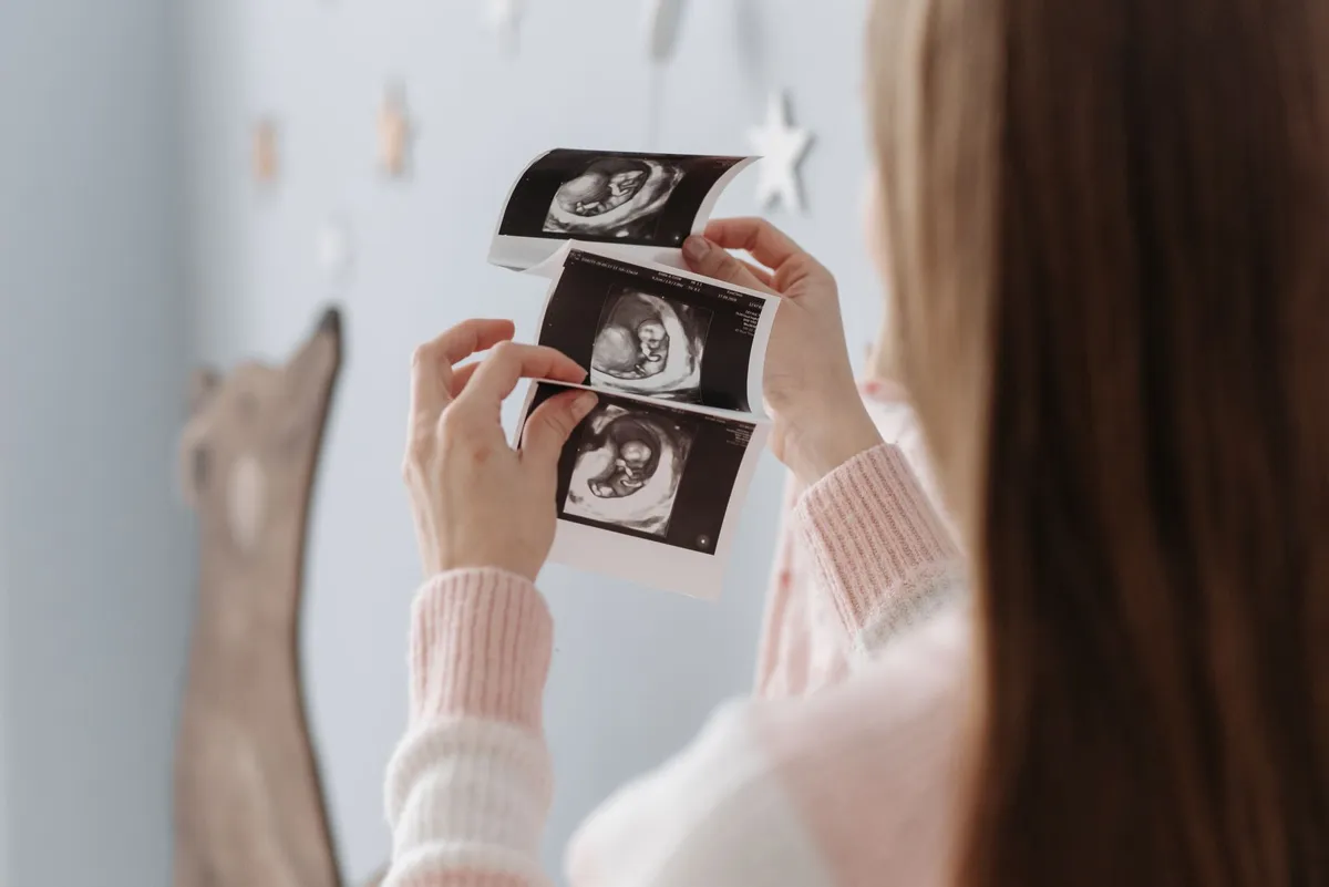 Person holding ultrasound images of a fetus in a cozy setting.