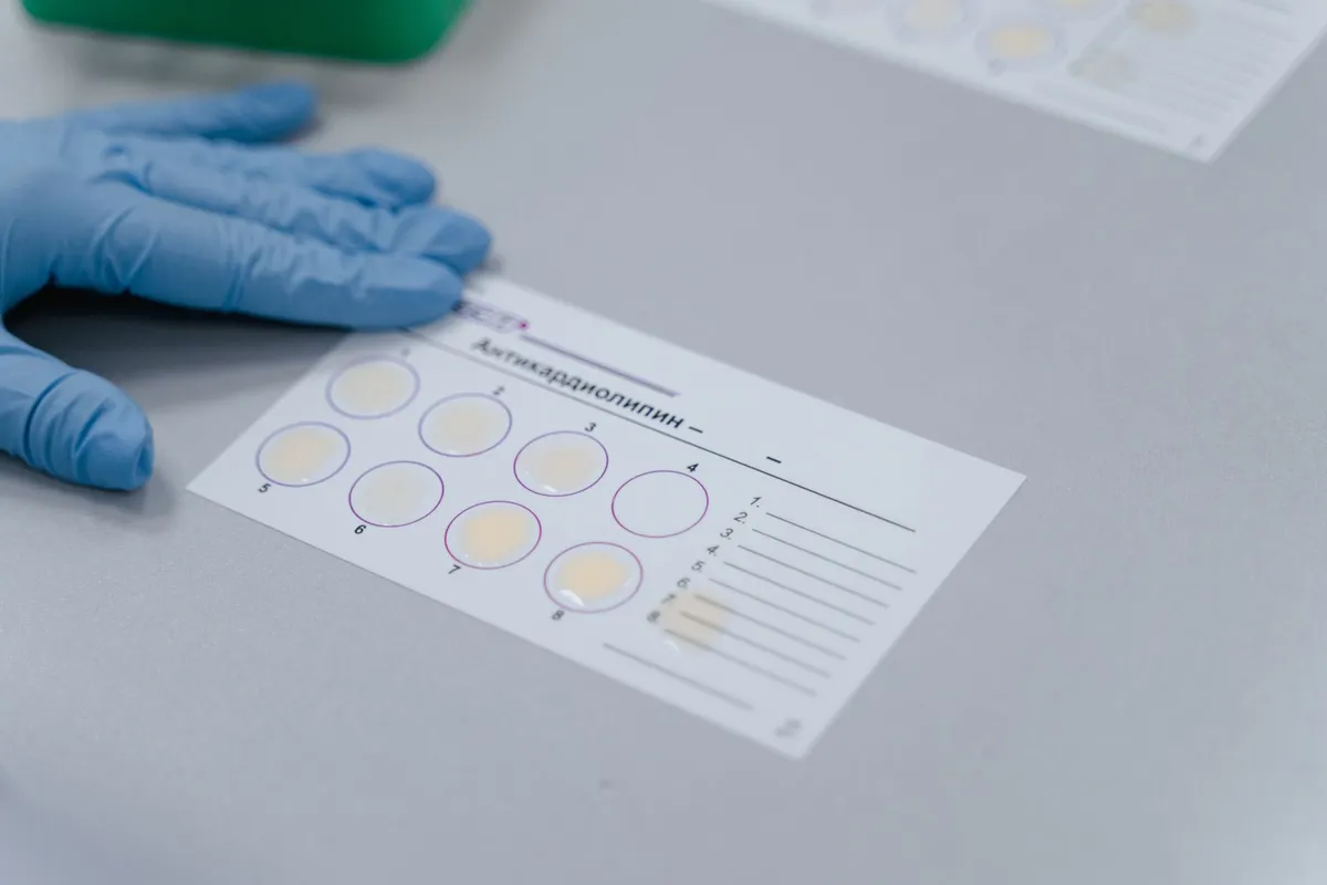Allergy test results with marked reactions on a card and gloved hand nearby.