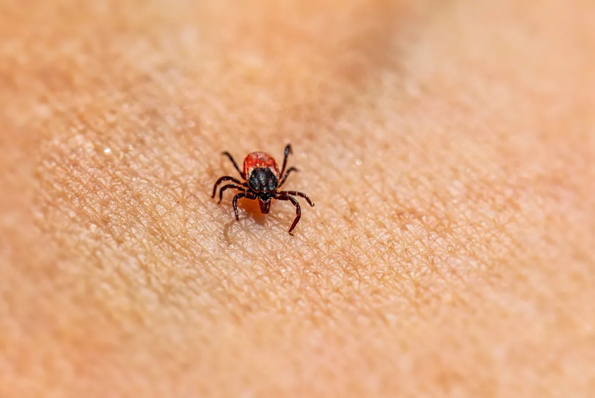 Close-up of a tick on human skin, illustrating tick-borne illness risk.
