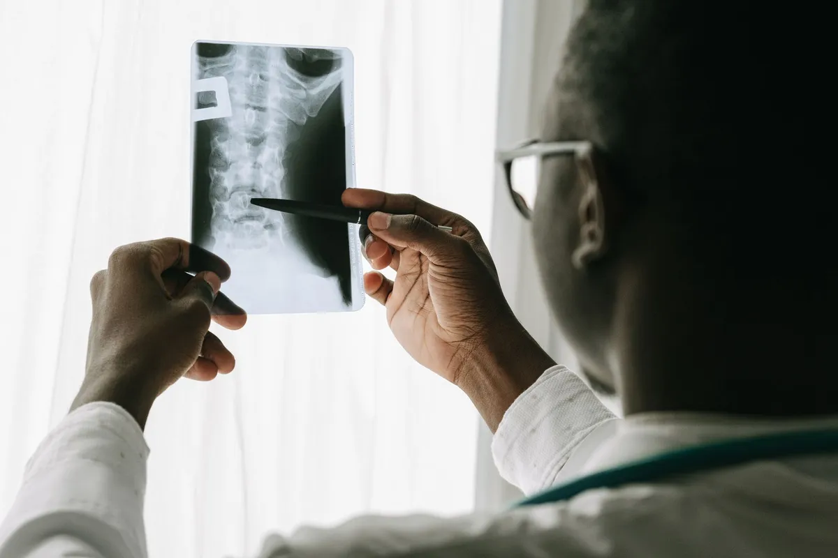Doctor examining a cervical spine X-ray for signs of ankylosing spondylitis.
