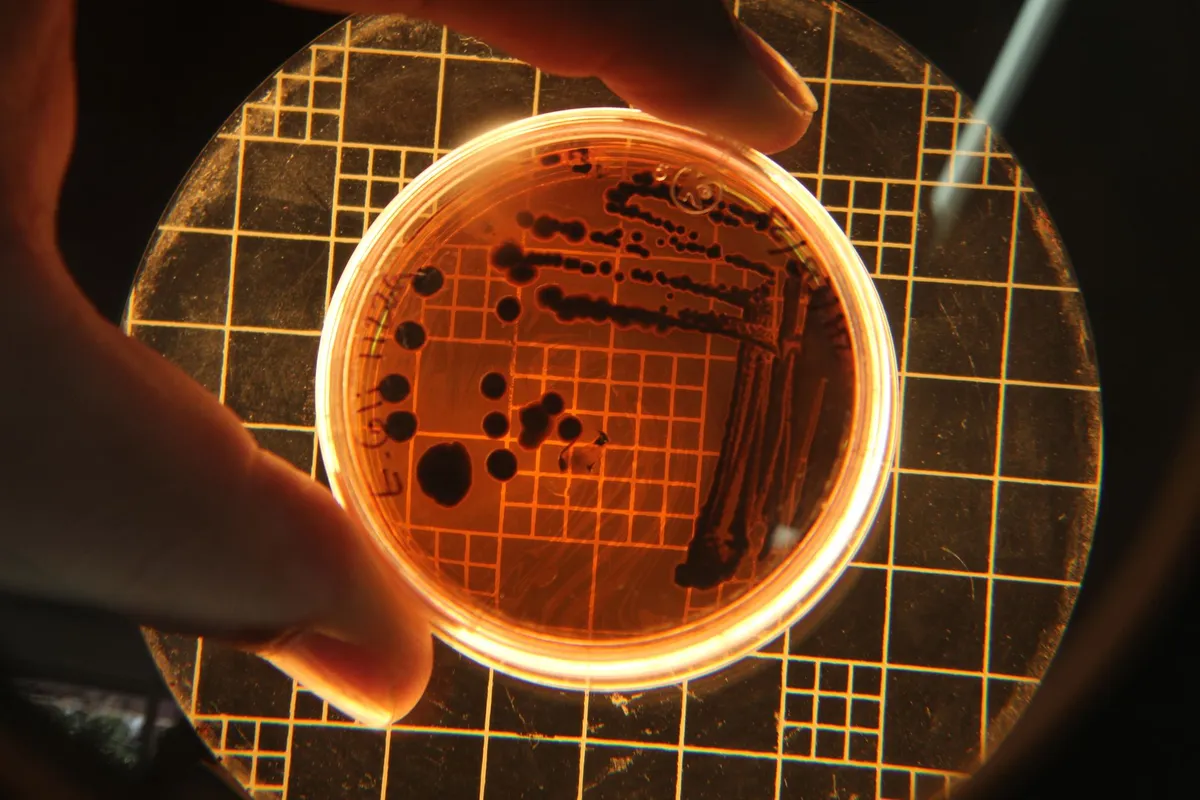 Petri dish with bacterial colonies under a microscope