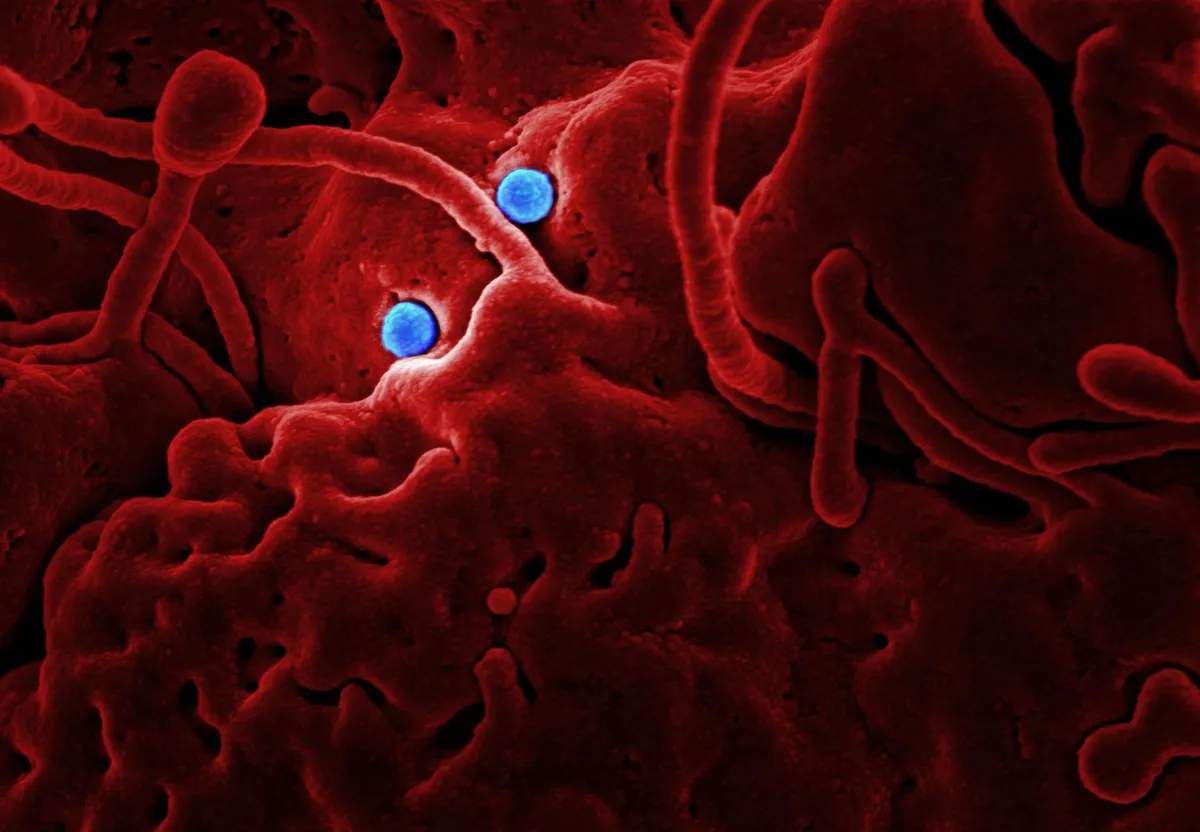 Close-up of cells with visible structures, relevant to oxidation and free radicals.