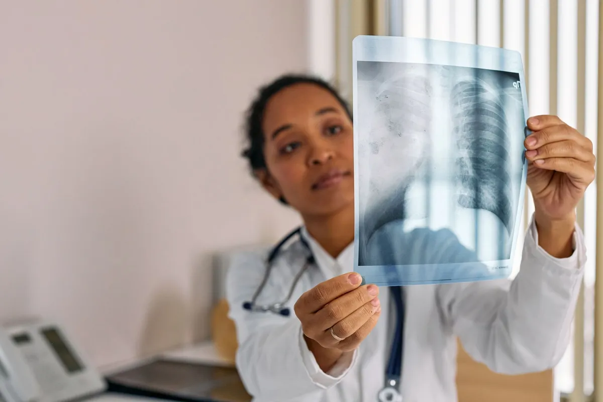 Doctor examining a chest X-ray showing lung details, relevant to asthma diagnosis.