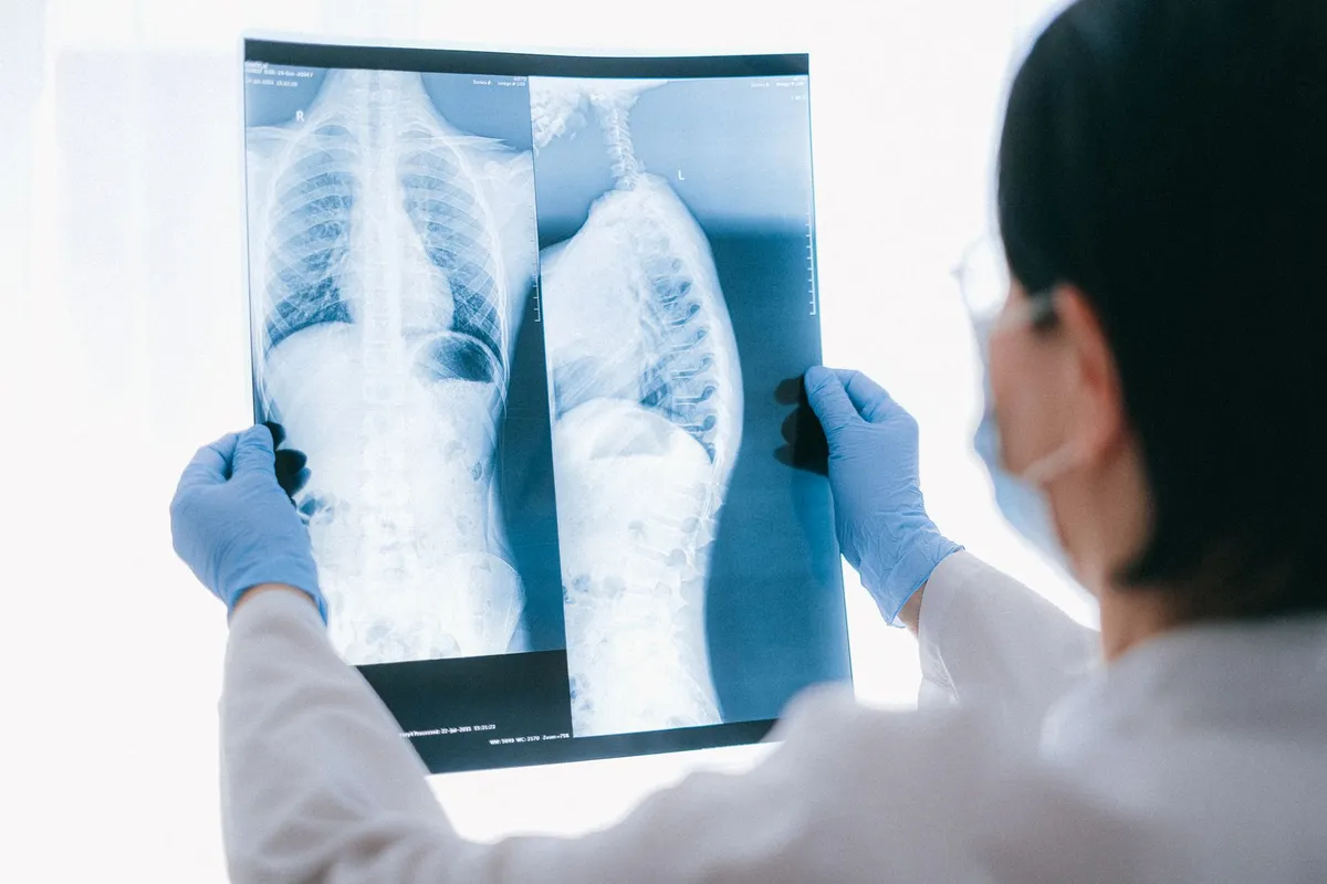 Doctor examining chest X-ray showing lung condition.