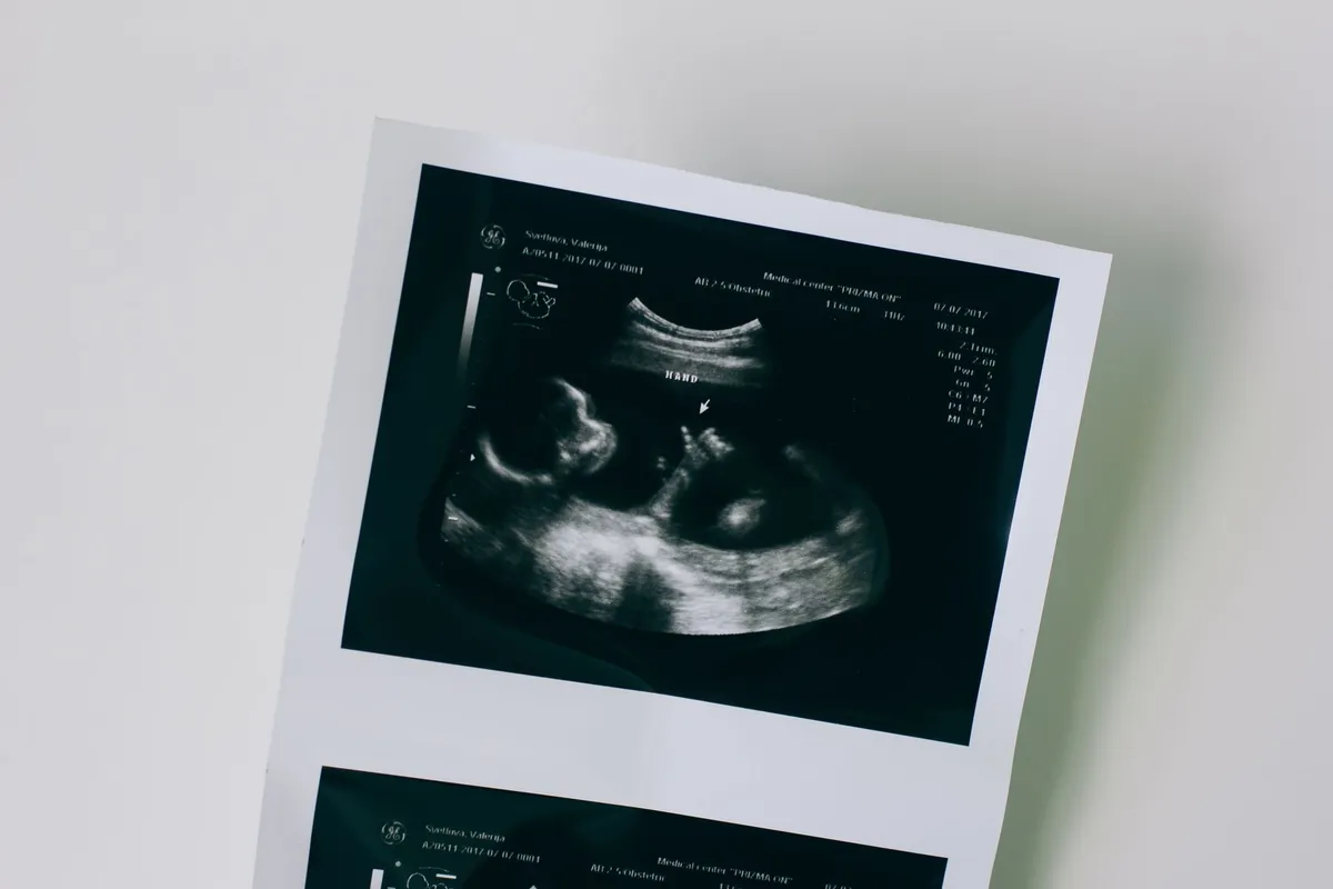Ultrasound image of a fetus on a printed sheet