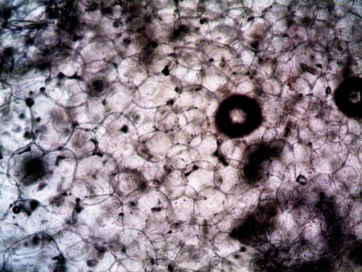 Microscopic view of cells, relevant for biopsy examination and diagnosis.
