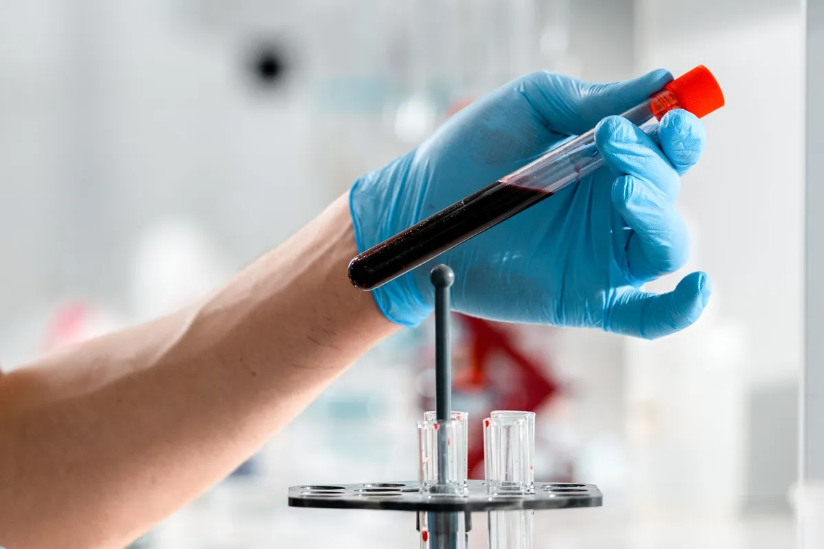 A gloved hand holding a blood sample tube in a laboratory setting.