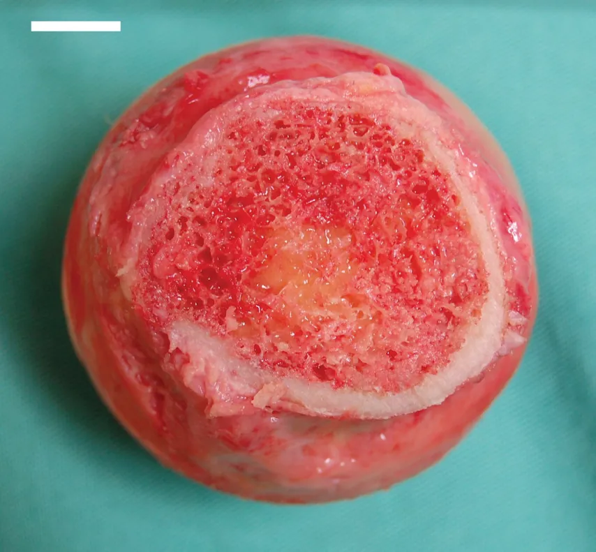 Cross-section of bone showing red bone marrow structure.