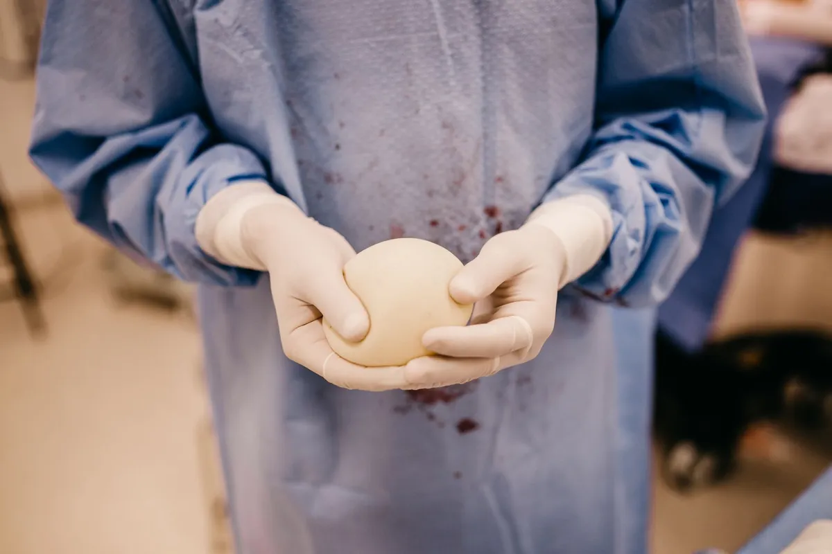 Surgeon holding a breast implant in a sterile environment.