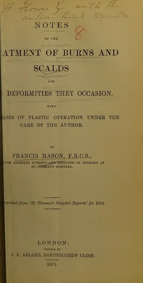Historical document on treatment of burns and scalds, detailing surgical procedures.