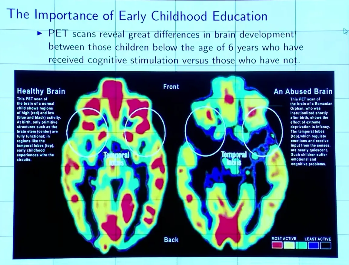 PET scans comparing brain activity in healthy and abused children under 6 years old.