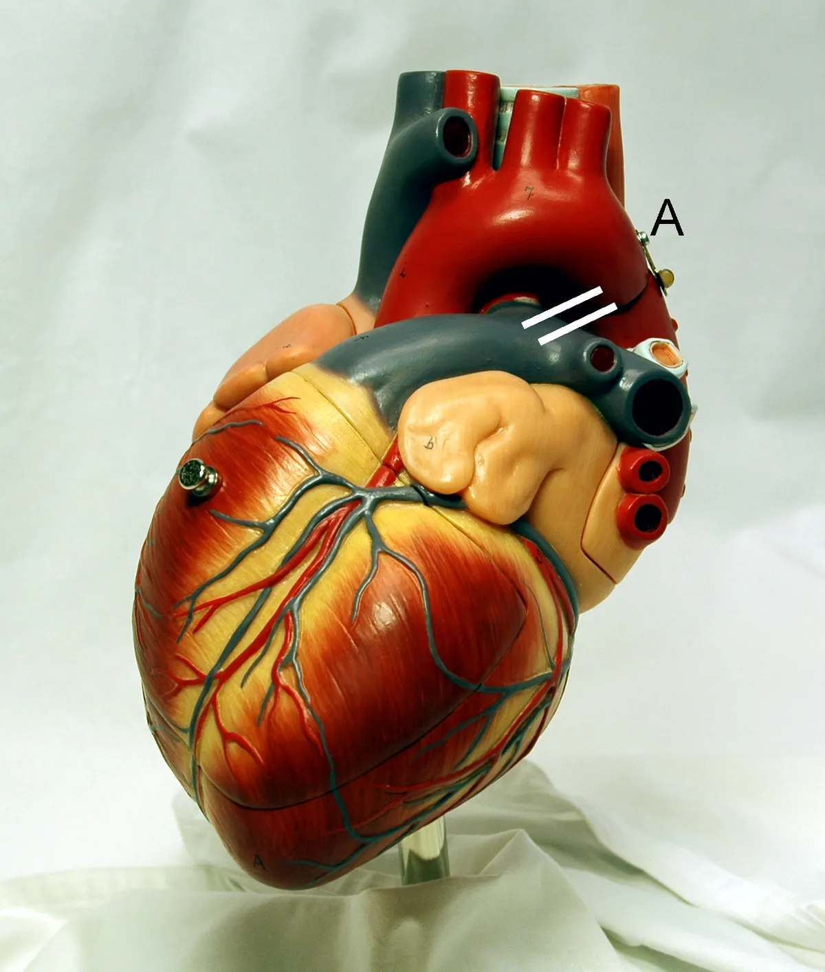 Anatomical model of a human heart showing blood vessels and chambers.